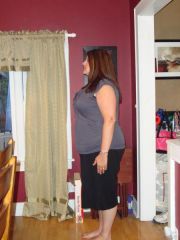 Four months post-op - 247 pounds