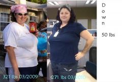 Down 50 lbs, had surgery 12/18/2009.