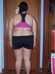 Bretteni 1 month post op back