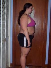 Bretteni 1 month post op side