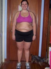 Bretteni 1 month post op front