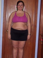 Bretteni front 2 month post op