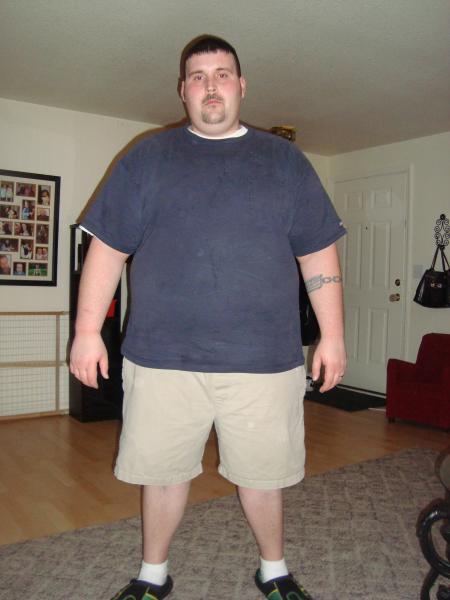 me before surgery
