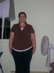 3 mos post op 36 lbs down