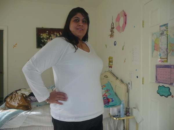 After 74 Lb Weight-Loss