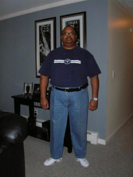 Pre-Surgery Photos