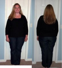 41 pounds lost
5 months post-op