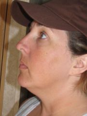 Another side view....this is where I can tell the most difference.