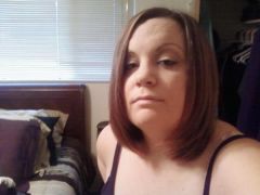 Me 38 lbs down 3 days before surgery.
