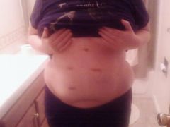 Day of Surgery!! 217 lbs