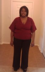 Jessie Valentine day 20109 days before surgery.lost 21pounds during pre-op