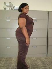 Day before surgery 06/11/09