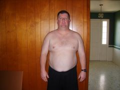 274- day of surgery /  2/22