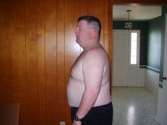 274 pounds-day of surgery
2/22