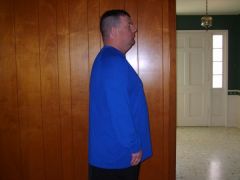 3/21  1 month  251 pounds