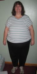 Feb4th before surgery