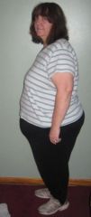 2nd Feb4th before surgery
