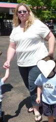 One month before surgery- July 2009