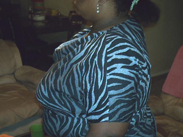 Before surgery pictures