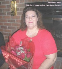 Christmas 2007
3 days before lapband surgery 256 lbs.