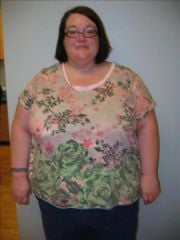 Pre Op Pic taken 1 week before surgery