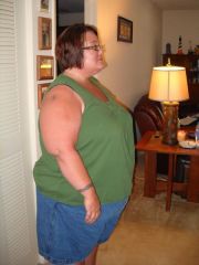 5 weeks post op  Down 41 pounds