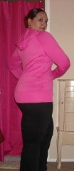 Irene March 2011 6 Mos Post Op 1.jpg