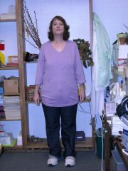 200 lb weight loss
