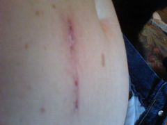Private Photos 095