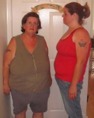 My mom and I 9 weeks after our surgery