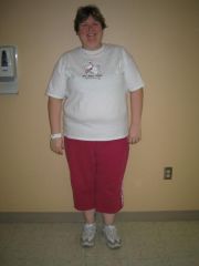Before surgery taken March 18, 2010 on day of pre-op testing.