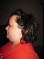 Horrible chin...no wonder I have sleep apnea