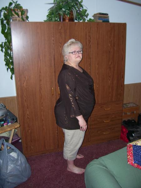 Before Band Surgery