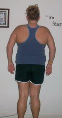 4.5 months post op 258