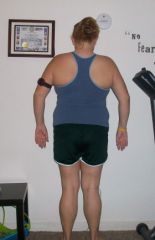 7 month post op.. 237.2lb