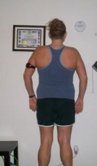 11months post op 214 lbs