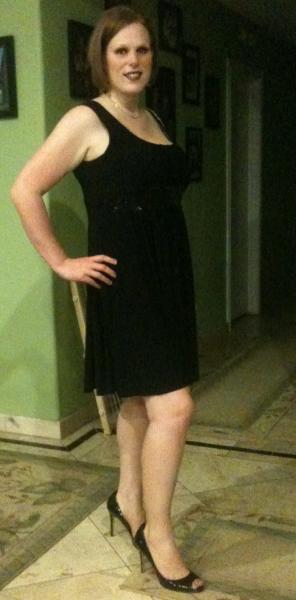 before my tummy tuck
