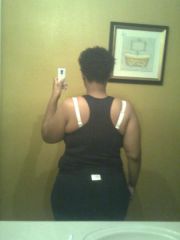 June 23 1mth post-op
now 252
was 273