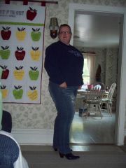 Me BEFORE surgery