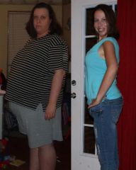 Before side view on left at 300 pounds and on right at 161.  I was 295 morning of surgery.  Its been about a year and a half and I've lost 134 pounds.  Best decision I've ever made.
