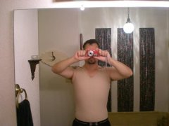 Post lipo and tuck, literally the first day.  Still have swelling and compression garments