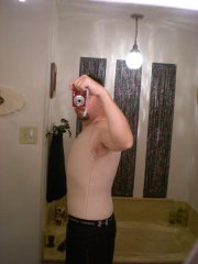 Post lipo and tuck, literally the first day.  Still have swelling and compression garments