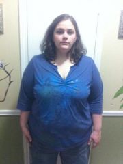 2.5 Mo Post Op299 Lbs47 Lbs LostBody