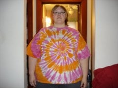 Night before surgery - November 23 2008 363 lbs Front View
