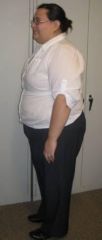 3 Months Post Op
86 pounds gone as of 11-12-2010.