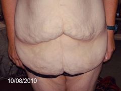 me b4 my tummy tuck which is happening 13/10/10