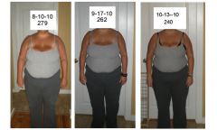 comparison front