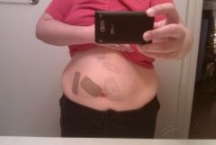 The day of sugery