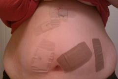 day of sugery