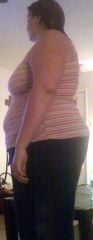 5 days post op (14 pounds down)